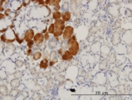 H00003064-M11 - Huntingtin