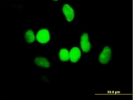 H00003070-B01 - SMARCA6 / HELLS