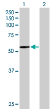 H00003073-B01P - Beta-hexosaminidase alpha / HEXA