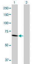 H00003073-D01P - Beta-hexosaminidase alpha / HEXA