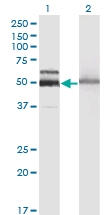 H00003073-M06 - Beta-hexosaminidase alpha / HEXA