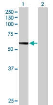 H00003074-B01P - Beta-hexosaminidase beta / HEXB