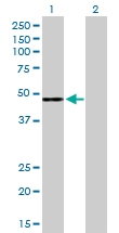 H00003075-D01P - Complement factor H (CFH)