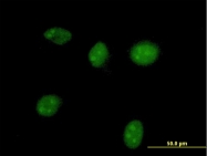 H00003081-B01P - Homogentisicase / HGD