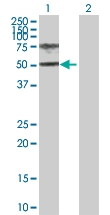 H00003081-D01P - Homogentisicase / HGD
