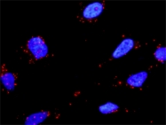 H00003082-D01P - Hepatocyte growth factor / HGF