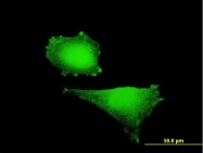 H00003091-B01P - HIF1A / HIF1 alpha