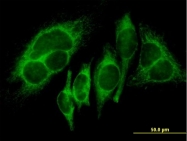 H00003098-B01 - Hexokinase-1