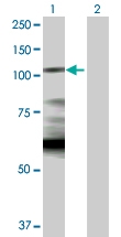 H00003098-D01P - Hexokinase-1
