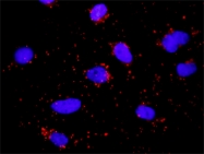 H00003117-M01 - HLA class II DQ alpha 1 / HLA-DQA1