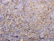 H00003126-M01 - HLA Class II DR beta 4 / HLA-DRB4