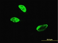 H00003131-M04 - Hepatic leukemia factor / HLF