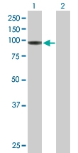 H00003141-B01P - Biotin-protein ligase / HLCS