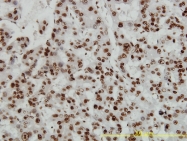 H00003146-M02 - HMGB1