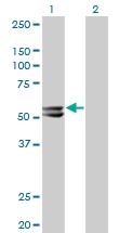 H00003158-M06 - mHMG-CoA synthase / HMGCS2