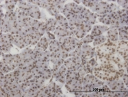 H00003167-M07 - HMX2