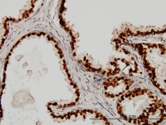 H00003169-M01 - FOXA1 / TCF3A