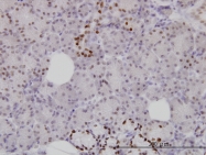 H00003169-M02 - FOXA1 / TCF3A