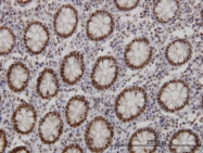 H00003169-M03 - FOXA1 / TCF3A