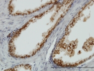 H00003169-M05 - FOXA1 / TCF3A