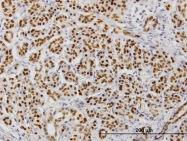 H00003170-M12 - FOXA2 / HNF3B