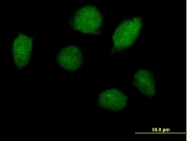 H00003198-B01P - HOXA1 / HOX1F