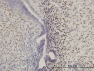 H00003207-M05 - HOXA11 / HOX1I