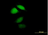 H00003208-B01P - HPCA / Hippocalcin