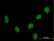 H00003217-D01P - HOXB7 / HOX2C