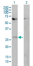H00003217-M01 - HOXB7 / HOX2C