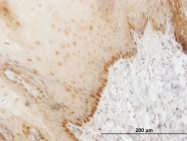 H00003217-M03 - HOXB7 / HOX2C