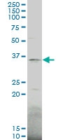 H00003231-A01 - HOXD1 / HOX4G