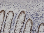 H00003237-M10 - HOXD11 / HOX4F