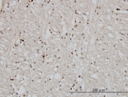 H00003300-M03 - DNAJB2