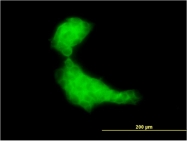 H00003300-M03 - DNAJB2