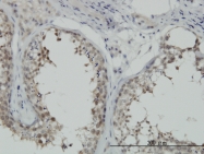 H00003304-M02 - Heat shock protein 70 / HSP70