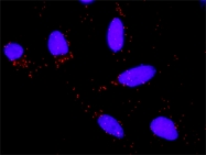 H00003304-M02 - Heat shock protein 70 / HSP70