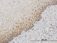 H00003304-M05 - Heat shock protein 70 / HSP70