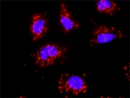 H00003304-M05 - Heat shock protein 70 / HSP70