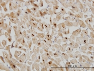 H00003306-M04 - HSPA2