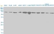H00003306-M06 - HSPA2
