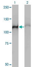 H00003308-M01 - HSPA4 / APG2