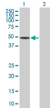 H00003426-B01 - Complement factor I