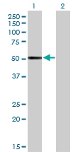 H00003426-D01P - Complement factor I