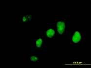 H00003428-B01 - IFI16 / IFNGIP1