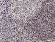 H00003428-M03 - IFI16 / IFNGIP1