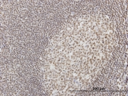 H00003428-M04 - IFI16 / IFNGIP1