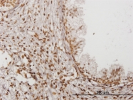 H00003428-M05 - IFI16 / IFNGIP1