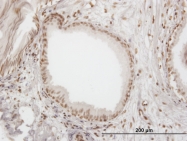 H00003428-M06 - IFI16 / IFNGIP1