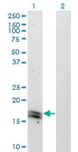 H00003440-M31 - IFNA2 / Interferon alpha-2